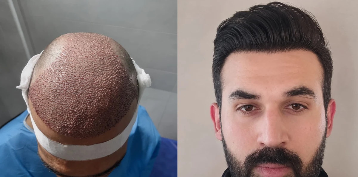 From procedure day to result: before and after